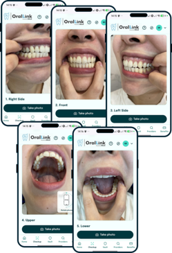 Five guided dental photos taken on a smartphone