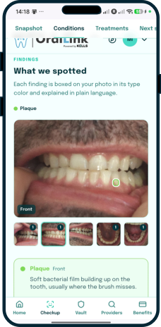 OralLink AI dental screening report